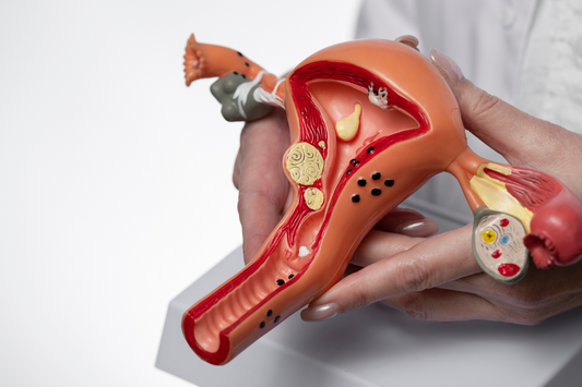 Endometriose profunda: entenda o que é e como tratar